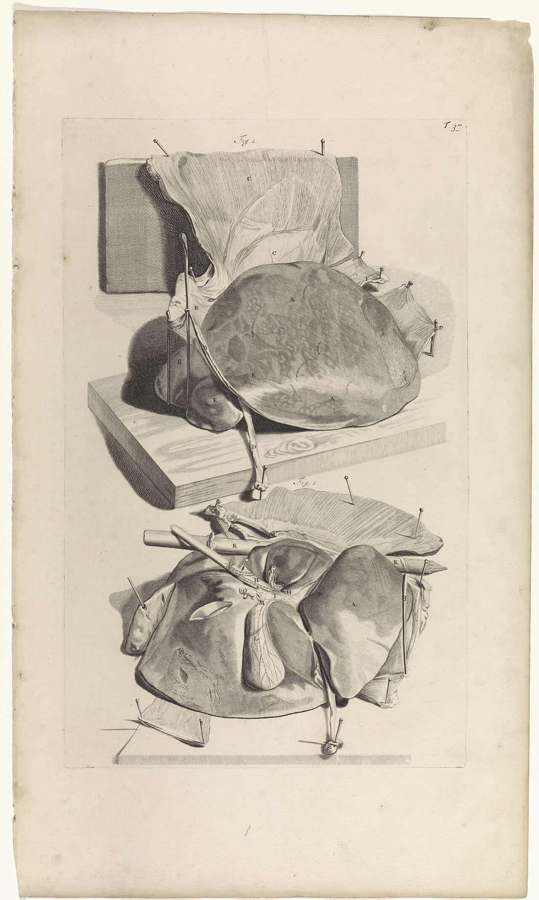 Anatomical study of the liver, Rijksmuseum print