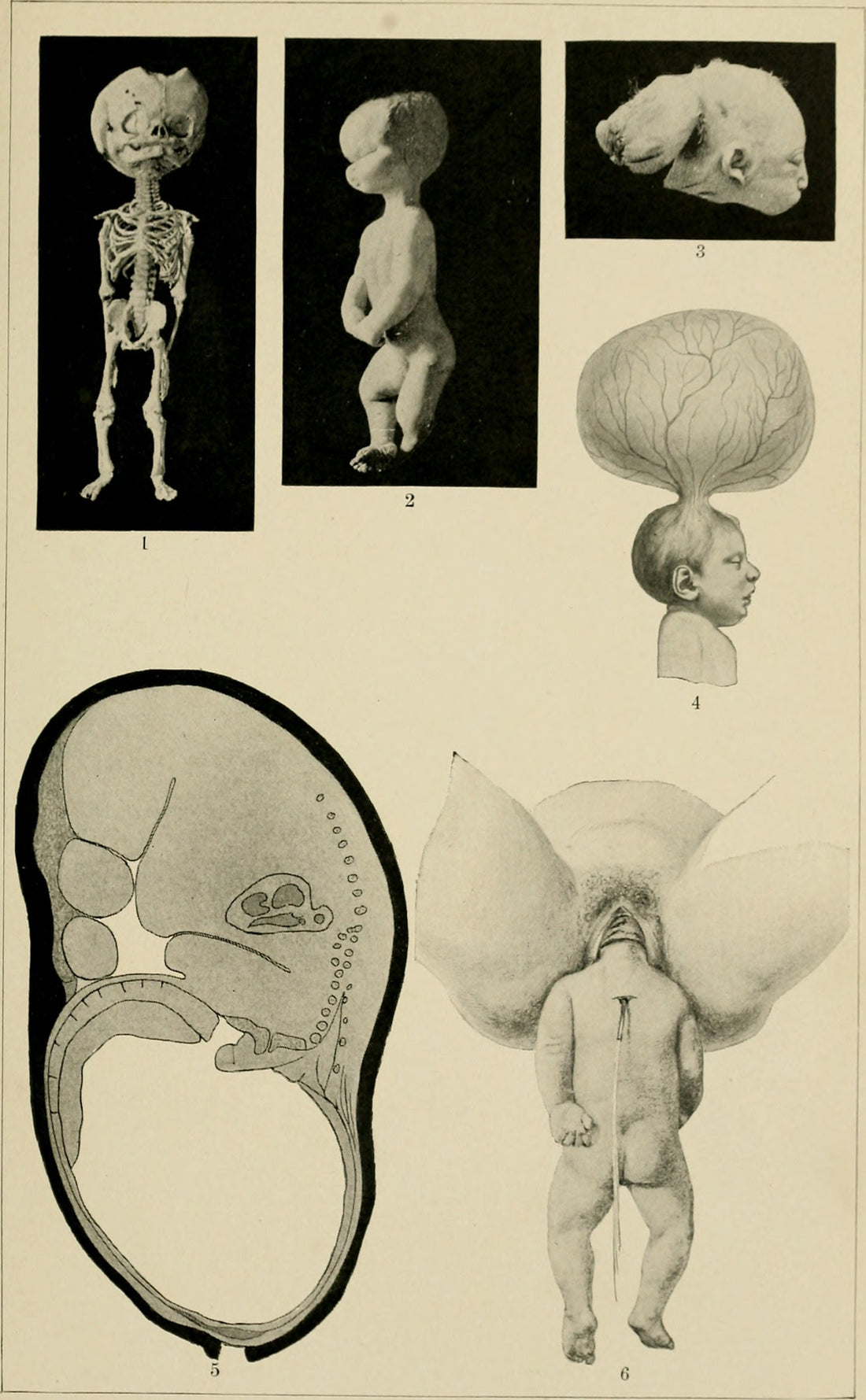 American Text-Book of Obstetrics (1903), historical female anatomy