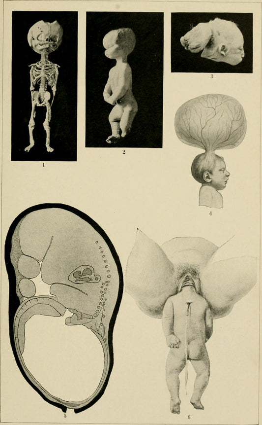 American Text-Book of Obstetrics (1903), historical female anatomy